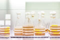 Cell Culture Samples On Lb Agar Medium In Petri Dishes And Erlenmeyer