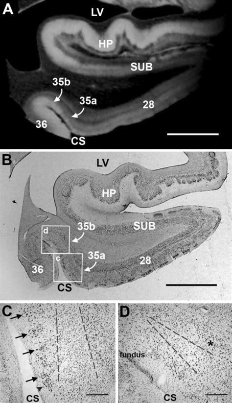 Histological validation of perirhinal cortex in ex vivo MRI. High ...