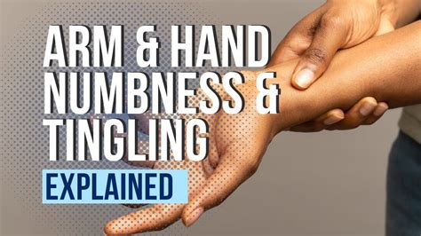 Understanding Hand Numbness Carpal Tunnel Syndrome And Beyond