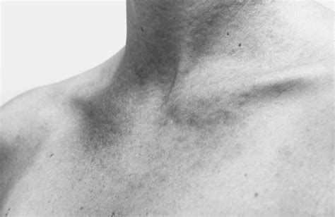 skin damage treatments  colorado springs springs body sculpting