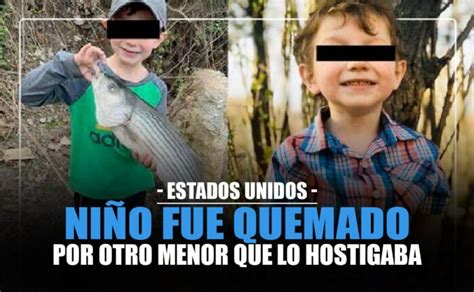 Perturba El Caso De Un Niño Que Fue Quemado Por Otro Menor Que Lo Hostigaba