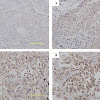 Immunohistochemical Staining Of Usp Protein In Nsclc Tissue Samples