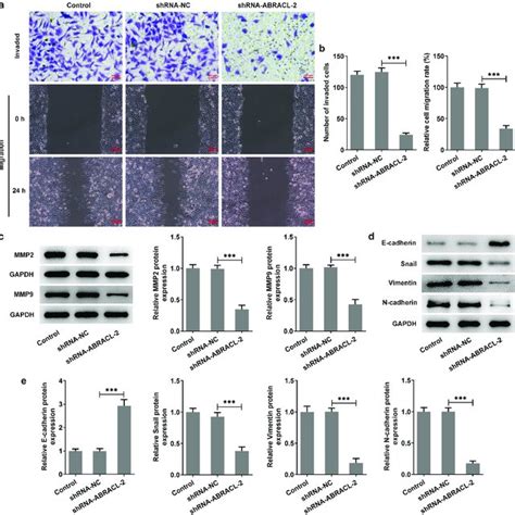 Knockdown Of Abracl Inhibits The Invasion Migration And Emt Of Breast