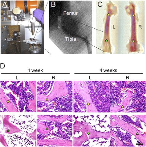 Irradiation Induces Bone Injury By Damaging Bone Marrow