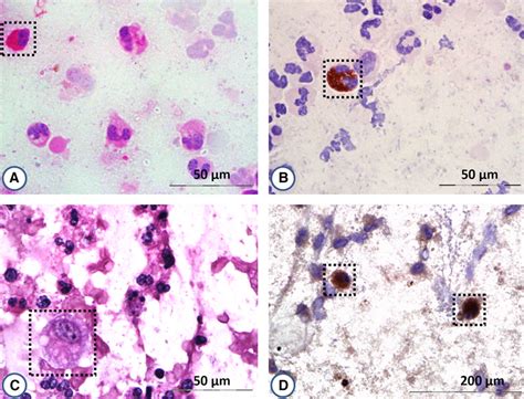 Distinct Inflammatory Cell Types Frequently Found In Samples From Ibd Download Scientific