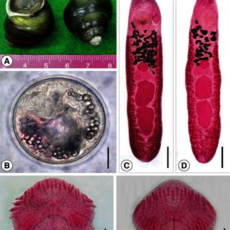 The Snail Host Metacercariae And Adults Of Echinostoma Macrorchis