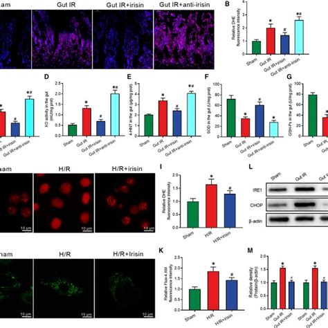 Irisin Decreases The Oxidative Stress Calcium Influx And ER Stress