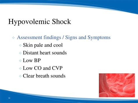 Ppt Concepts Of Normal Hemodynamics And Shock Powerpoint Presentation