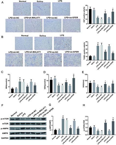 Downregulation Of MALAT1 Or Overexpression Of GFER Suppresses ALI In