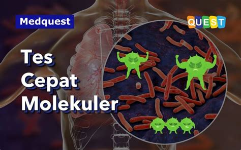 Panduan Lengkap Tes Cepat Molekuler Tcm Deteksi Tbc Ro