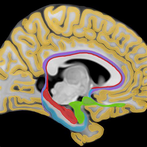 MRI anatomical landmarks of the Peri-archicortex limits. (a) Coronal ...