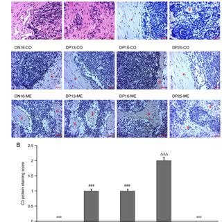 Immunohistochemical Localization Of C Protein In The Lymph Nodes From