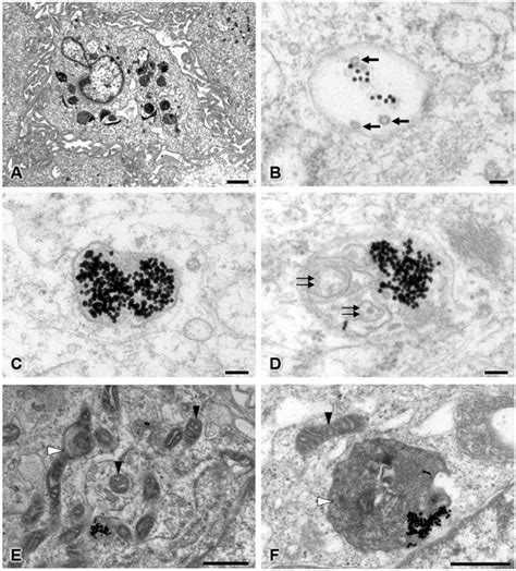 Transmission Electron Microscopy Of The 30 Ppm AuNP Treated Pericyte