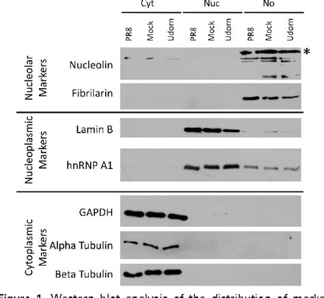 Figure 1 From Quantitative Proteomics Using SILAC Coupled To LC MS MS