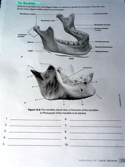 Solved Text Biol Lab Axial Skeleton The Mandible The