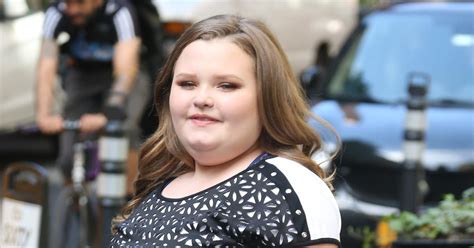 Alana Honey Boo Boo Thompson To Undergo 13k Weight Loss Surgery