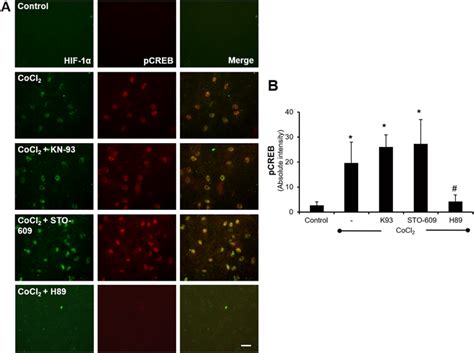 Effect Of Pka Inhibition On The Expression Of Pcreb And Hif In