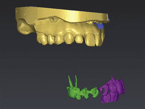 Surface Enamel Scan And Cone Beam Computed Tomography Scan Imported Download Scientific Diagram