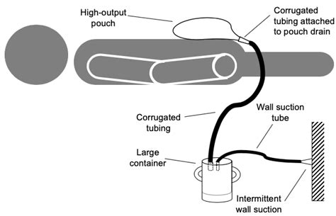 Knowledge Center Fistula Solution