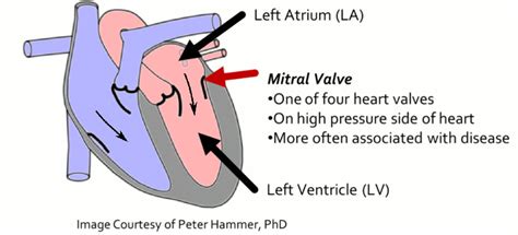 Mitral Stenosis Animation