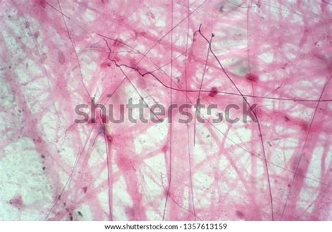 Areolar Connective Tissue Under Microscope View Stock Photo (Edit Now ...