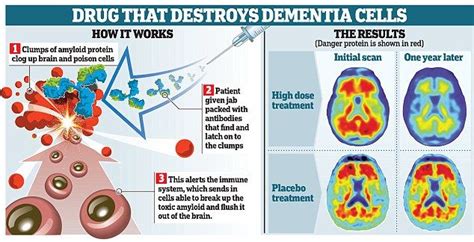 ‘Aducanumab’ – A Breakthrough or Not? - Dementia Solutions