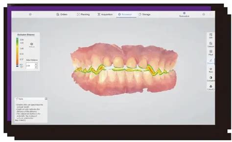 Eletra Smart Camera Et Scanner Intra Oral Labocast D