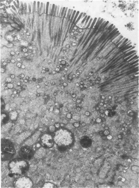 Low Power Electron Micrograph Of A Section Through LIM 1863 Cells That