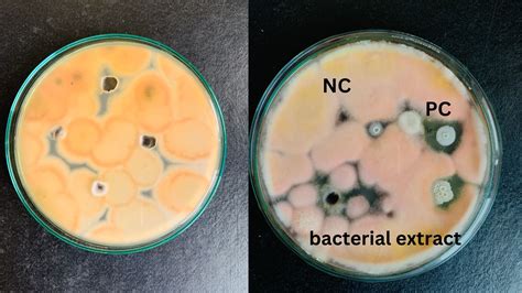 Antifungal Activity Definition Protocol And 1 Reliable Uses