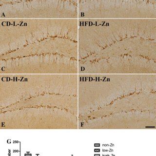 Immunohistochemistry For Ki In The Dentate Gyrus Of The Cd A