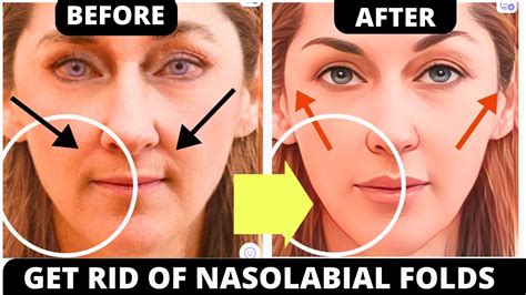 Top Face Lifting Exercises For Nasolabial Folds Jowls Saggy Skin