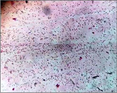 | Glass slides incubated with antibody-attached E. coli, as observed ...