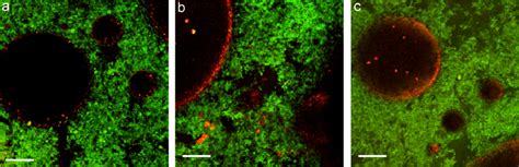 Confocal Scanning Laser Micrographs Observed In The Whipped Emulsions