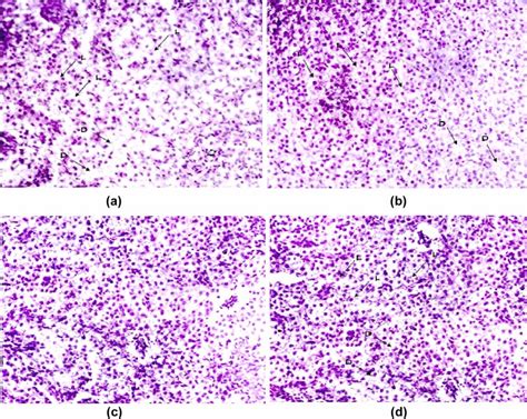 Histopathological Analysis Of Liver Tissue In Cssenc Administrated