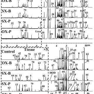 Representative Mhz H Nmr Spectra Of The Serum Top Panel And