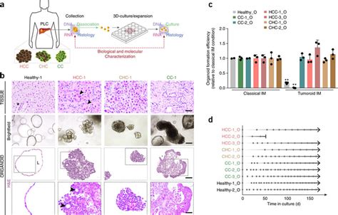 Patient Derived Primary Liver Cancer Organoid Cultures Expand Long Term