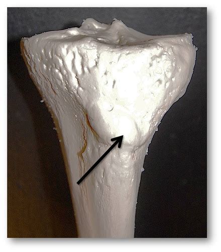 Tibia Fibula Patella Flashcards Quizlet