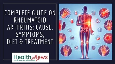 Complete Guide On Rheumatoid Arthritis Cause Symptoms And Treatment