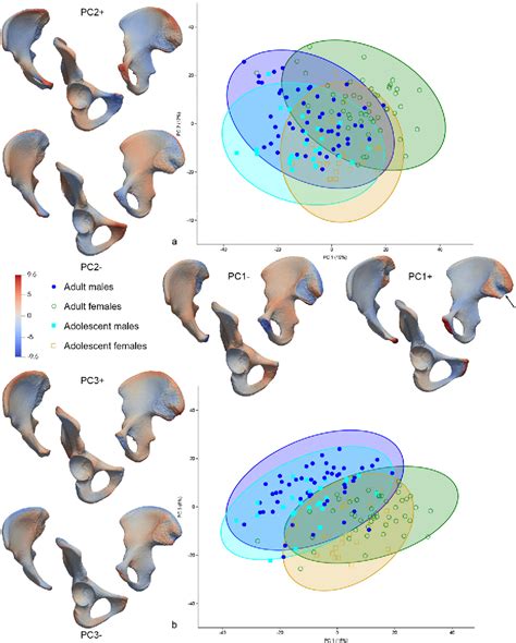 Figure 1 From New Insights On Hip Bone Sexual Dimorphism In Adolescents