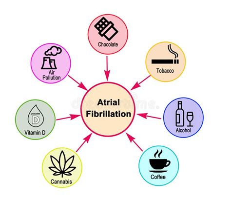 Causes of Atrial Fibrillation Stock Illustration - Illustration of ...