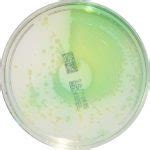 Cetrimide Agar Scheda Del Terreno Di Coltura Per Microbiologia