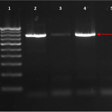 Gel Electrophoresis Showing Amplification Of 18s Rrna Gene Of Theileria