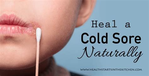 How To Heal A Cold Sore Naturally Health Starts In The Kitchen