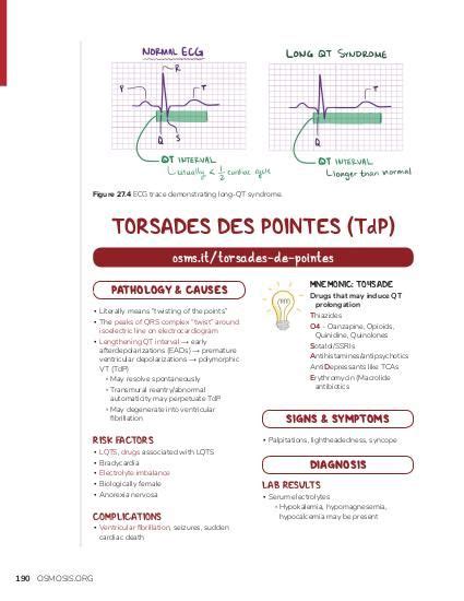 Long Qt Syndrome And Torsade De Pointes Osmosis