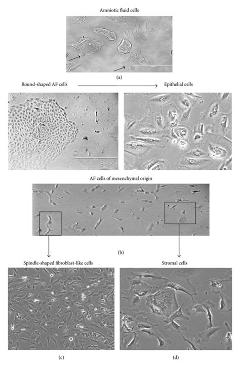 Morphological Characteristics Of Af Cells A Amniotic Fluid Cells