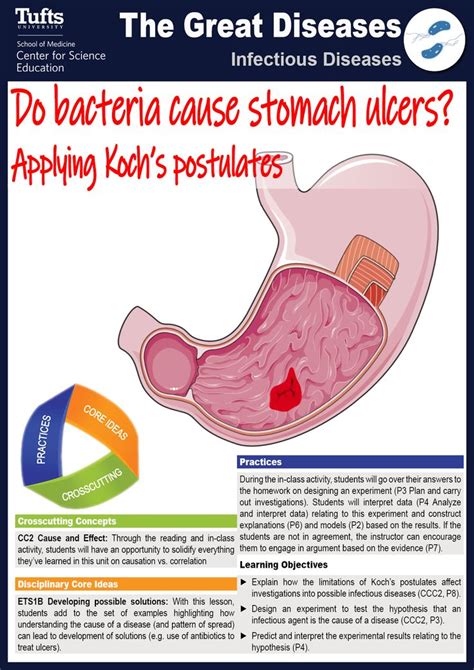 Do Bacteria Cause Stomach Ulcers Applying Kochs Postulates Free