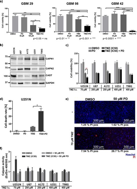 Temozolomide Tmz Sensitivity Of Primary And Established Gbm Cell