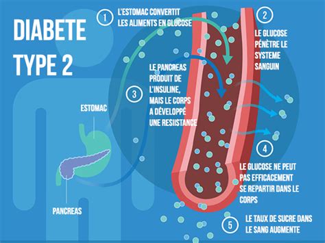 Diabète Définition Symptômes Et Traitements