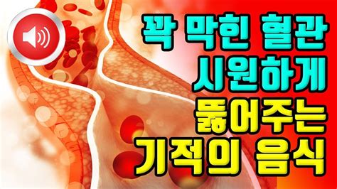 꽉 막힌 혈관 시원하게 뚫어주는 기적의 음식 9가지 Youtube