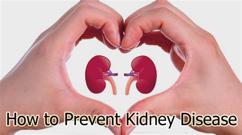 How To Prevent Kidney Disease